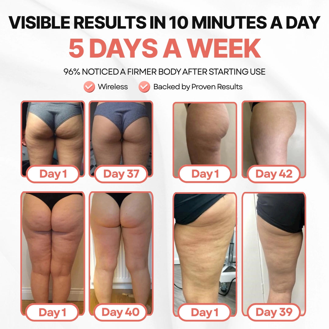 CelluminaSkin™ Anti-Cellulite Massager