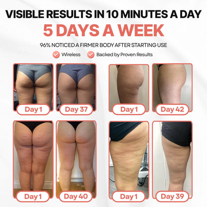 CelluminaSkin™ Anti-Cellulite Massager